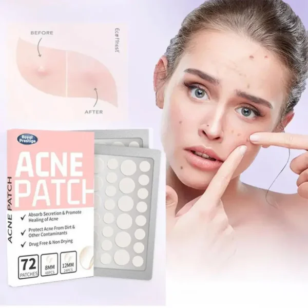 72Pcs Invisible Removal Pimple Acne Skin Problems Anti-Acne Hydrocolloid Patches Spots Marks Concealer Waterproof Repair Sticker